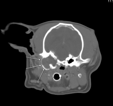 Transverse CT showing expanded and irregular, tissue filled left tympanic bulla
